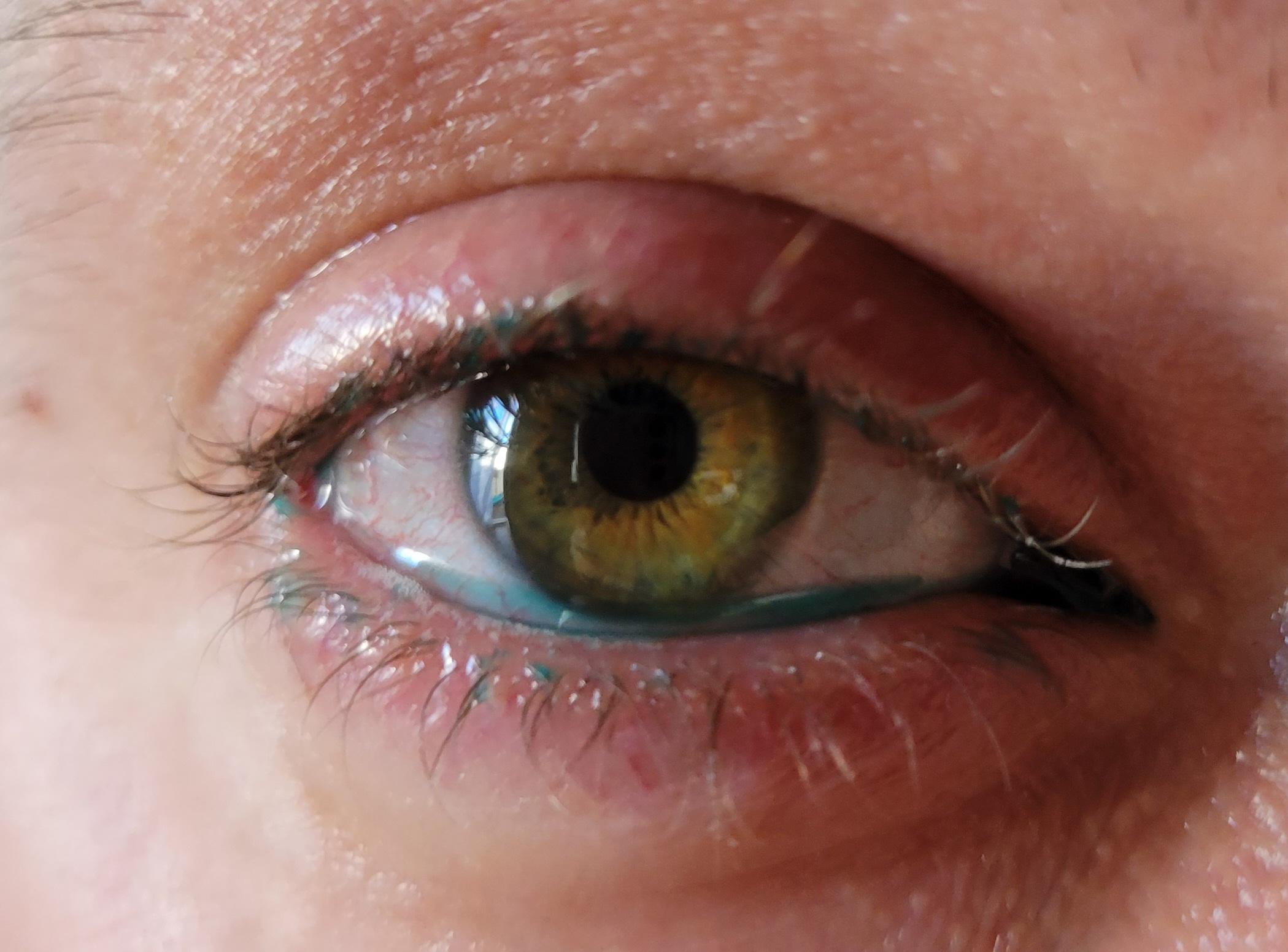barwienie powierzchni oka